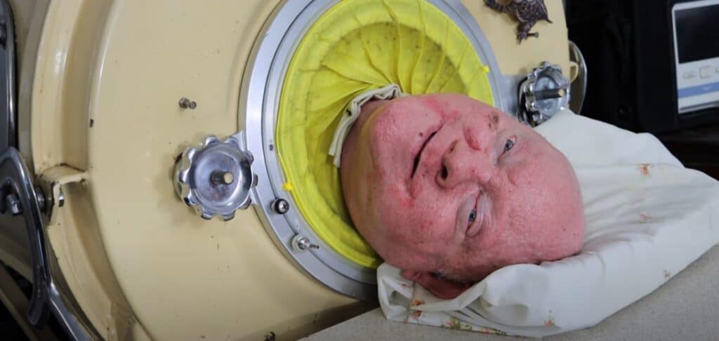 Meghalt a 70 évig vastüdőben élő Paul Alexander ACNEWS