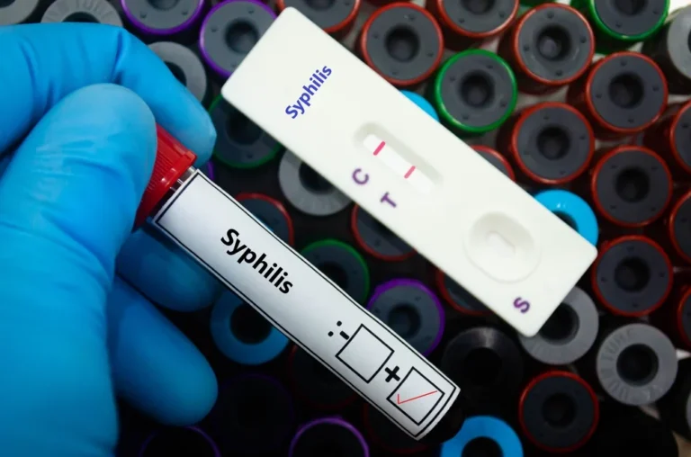 Illusztráció / Fotó: Shutterstock