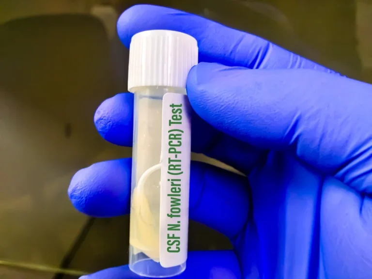 Fotó: Illusztráció / Shutterstock