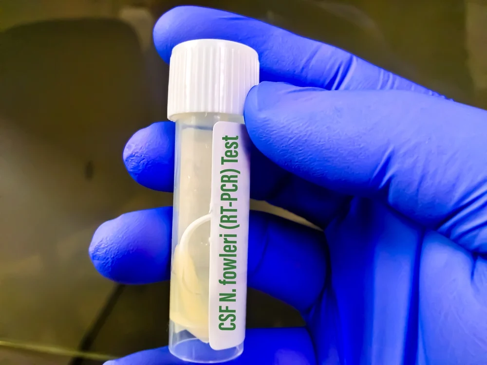 Fotó: Illusztráció / Shutterstock