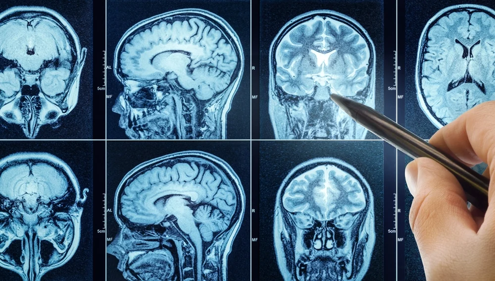 Illusztráció / Fotó: Shutterstock