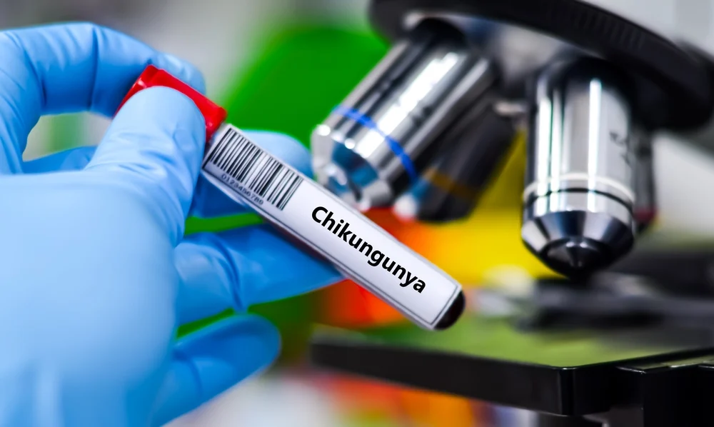 Illusztráció / Fotó: Shutterstock