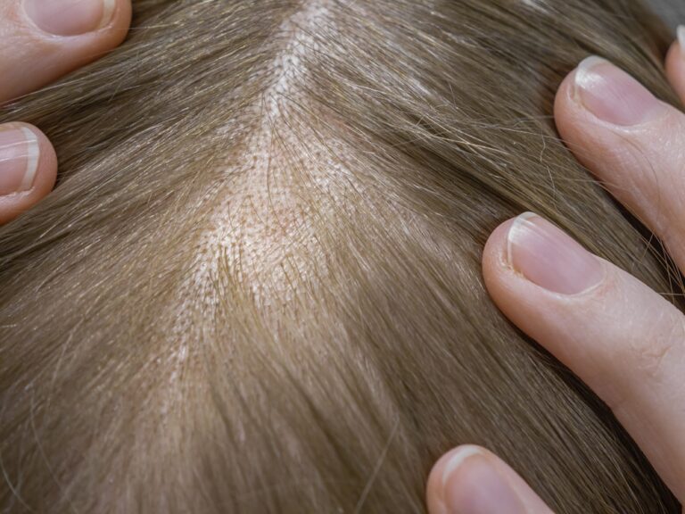 Illusztráció / Fotó: Shutterstock